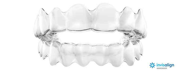Invisalign® in Ketsch: durchsichtige Zahnschienen / Aligner